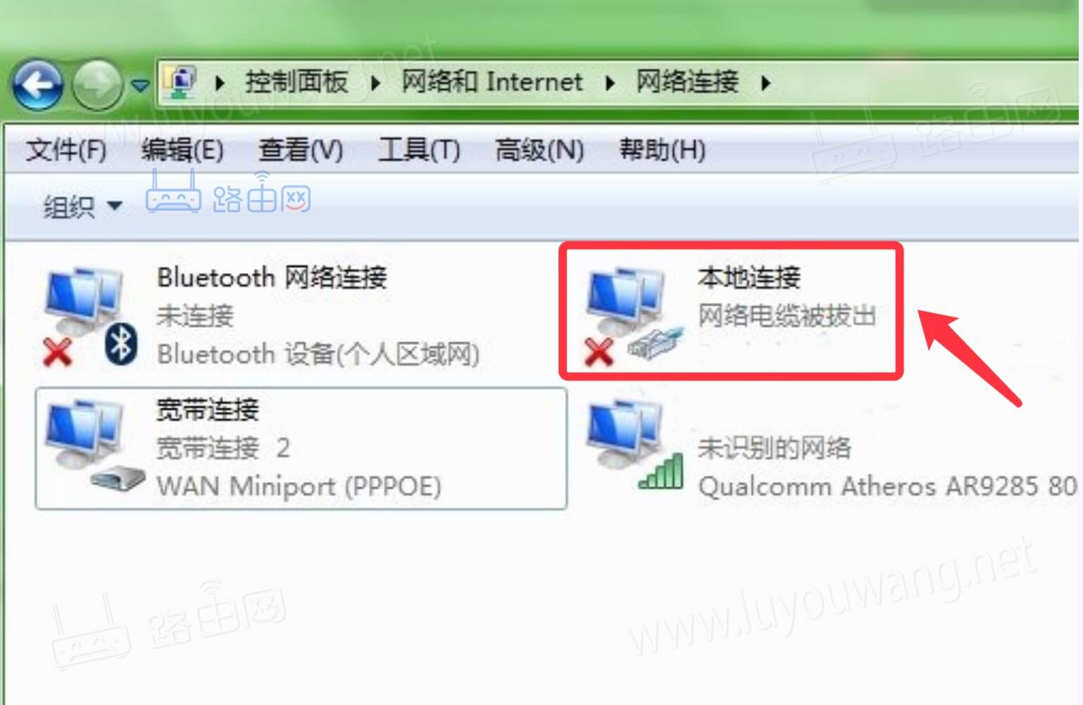 主机显示网络电缆被拔出